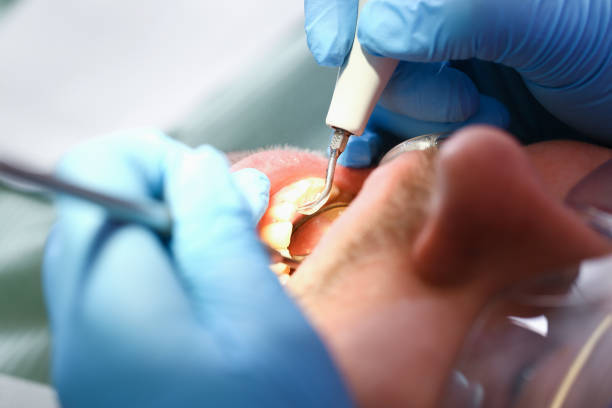 Best Mobile Emergency Dentist in Palm Springs, FL